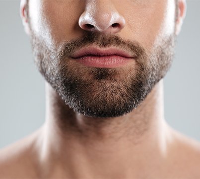 beard transplant