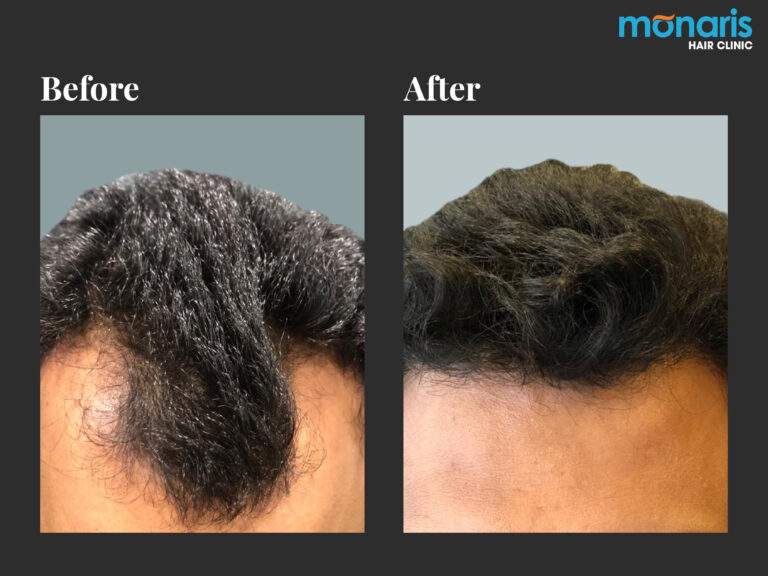 Patient comparison 23