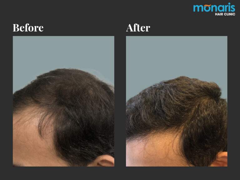 Patient comparison 22