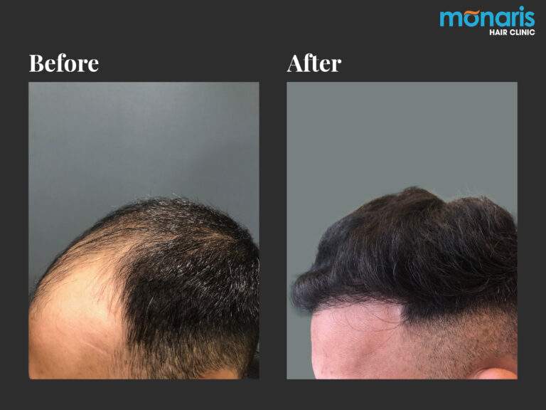 Patient comparison 21
