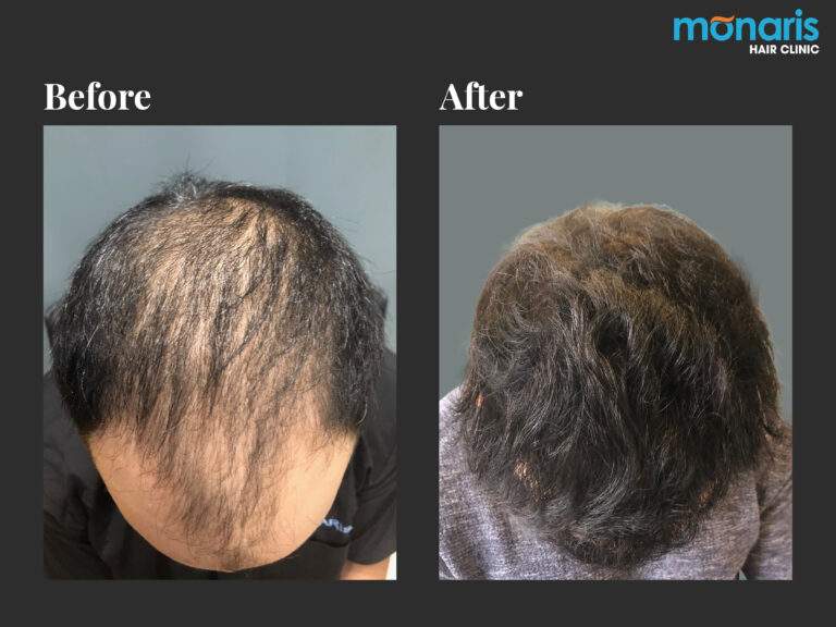 Patient comparison 18