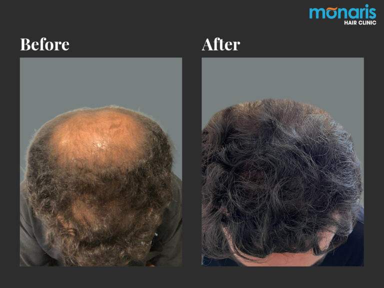 Patient comparison 16