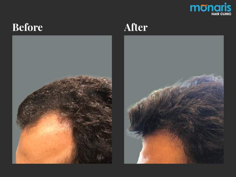 Patient comparison 15