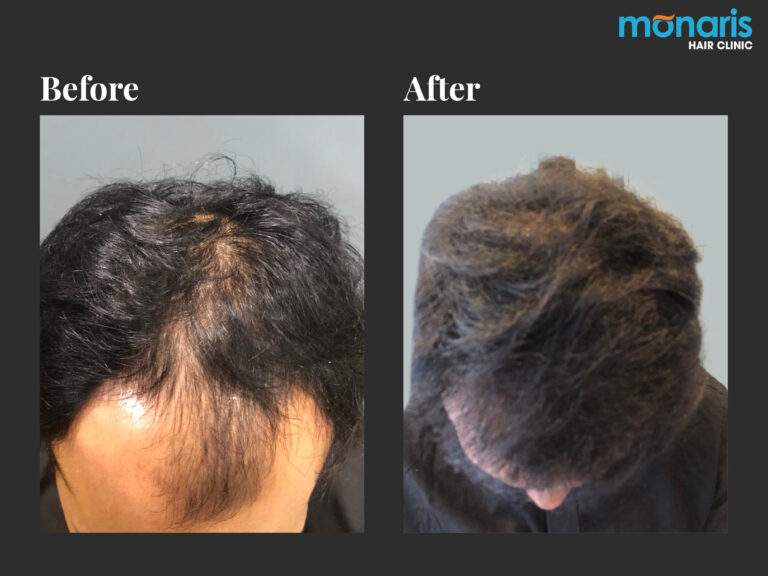 Patient comparison 14