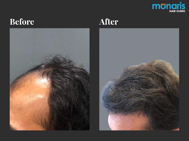 Patient comparison 12