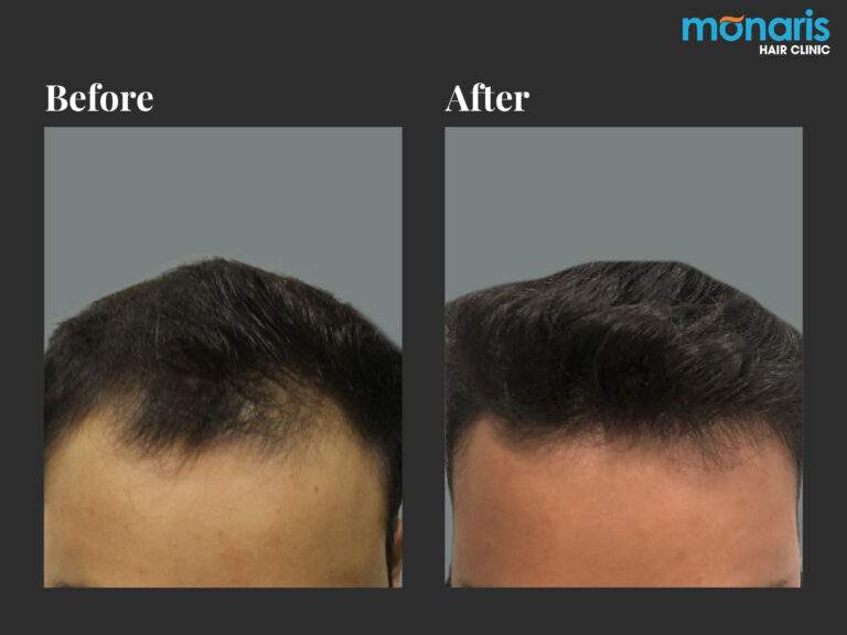 Patient comparison 11