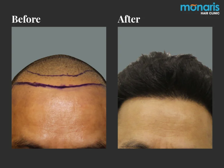 Patient comparison 8