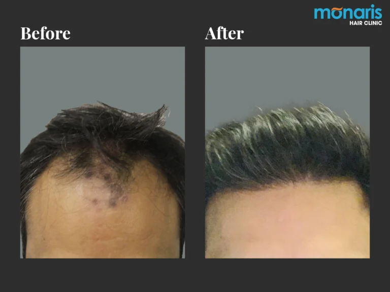 Patient comparison 10