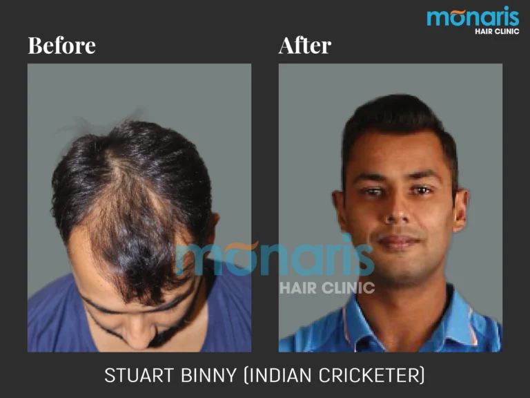 Stuart Binny · clinic gallery