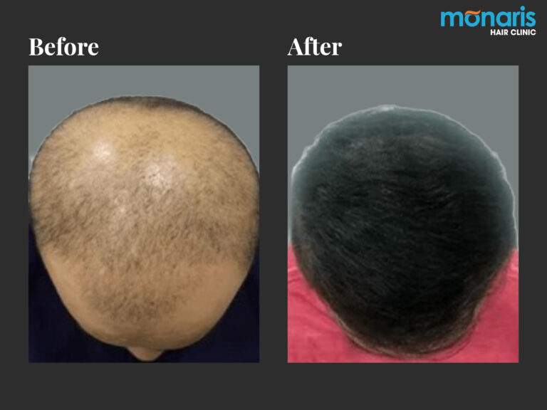 Patient comparison 25