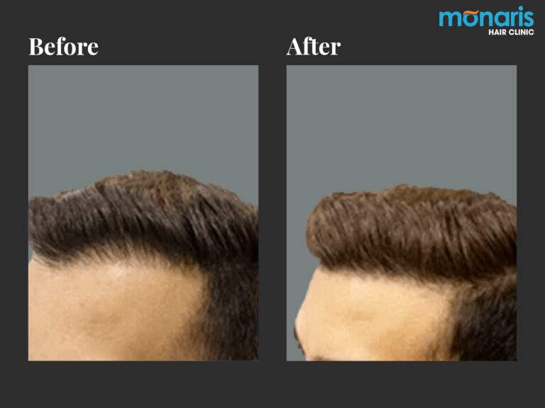 Patient comparison 24