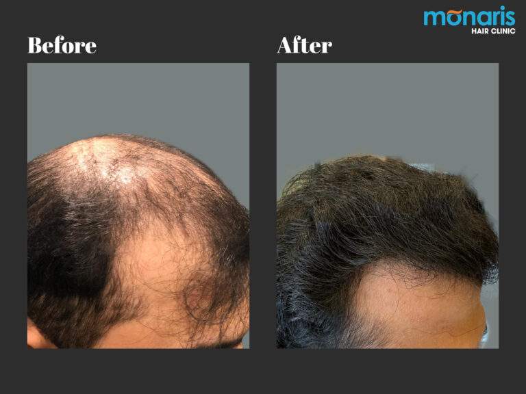 Patient comparison 20