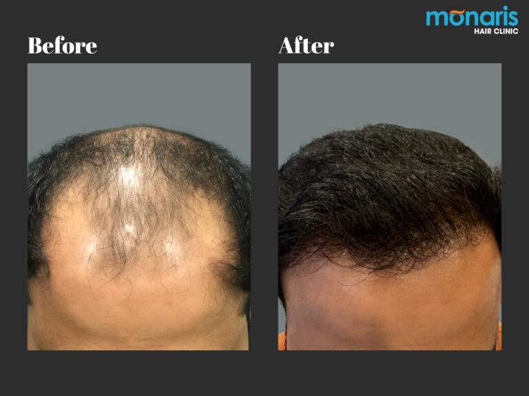 Patient comparison 26
