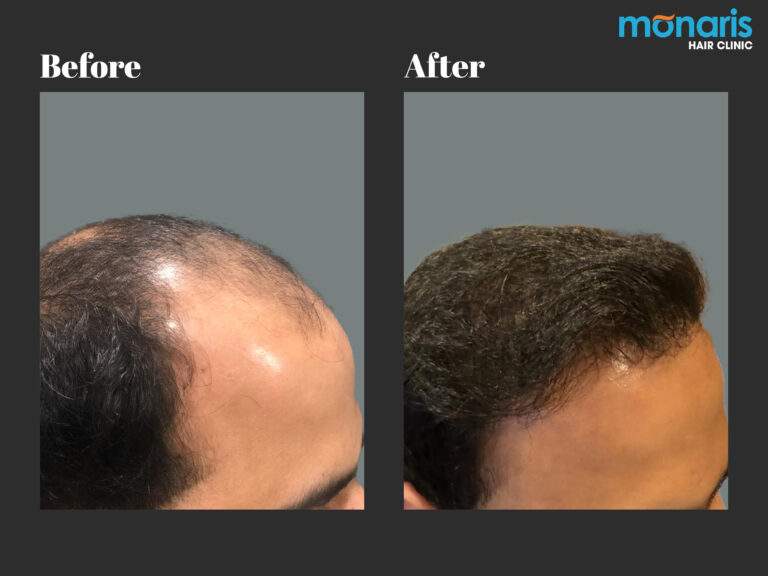 Patient comparison 19