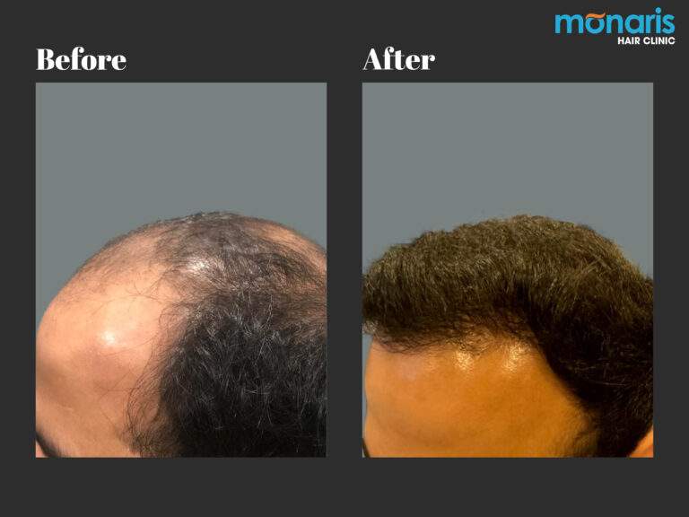 Patient comparison 17
