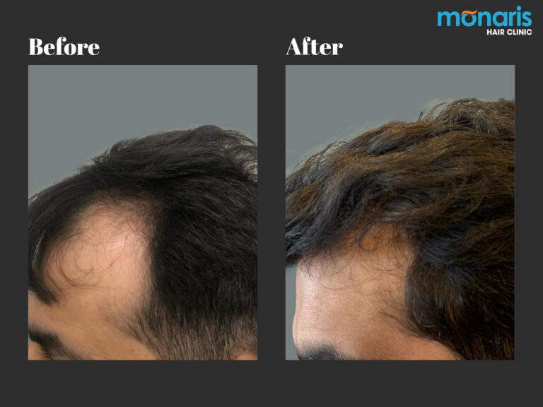 Patient comparison 27