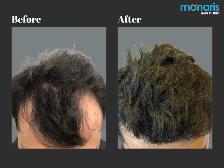 Patient comparison 28