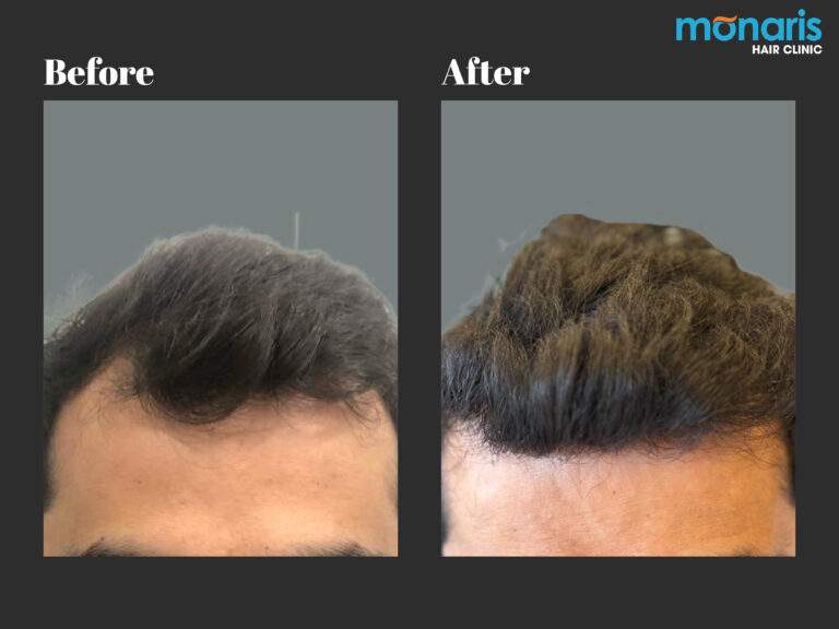 Patient comparison 29