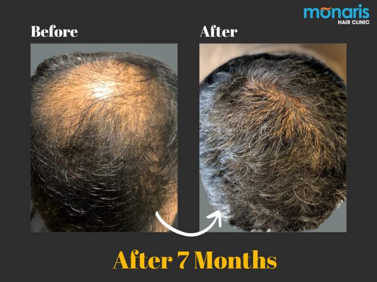 Patient comparison 7