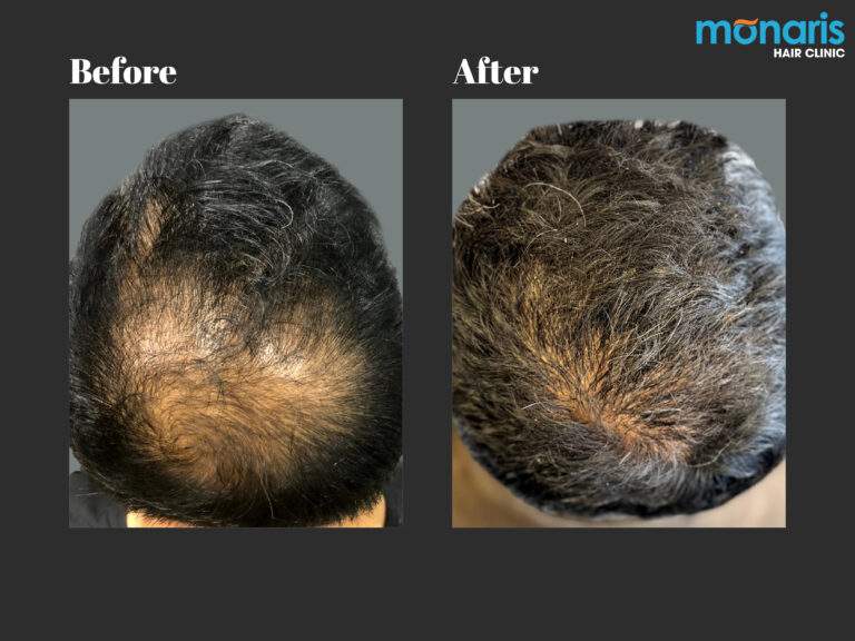 Patient comparison 30