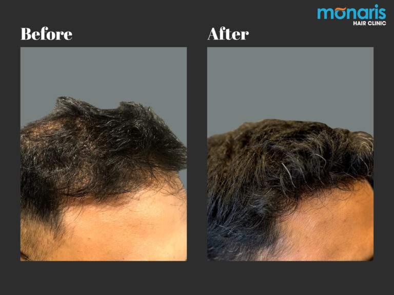 Patient comparison 31
