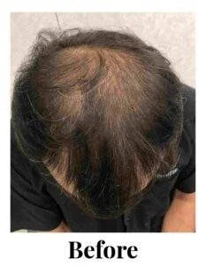 3 be compressed 233x300 1