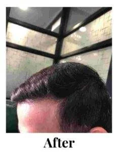 4 af compressed 233x300 1