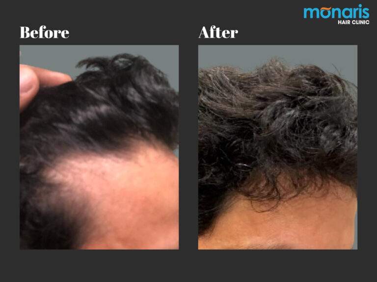 Patient comparison 32