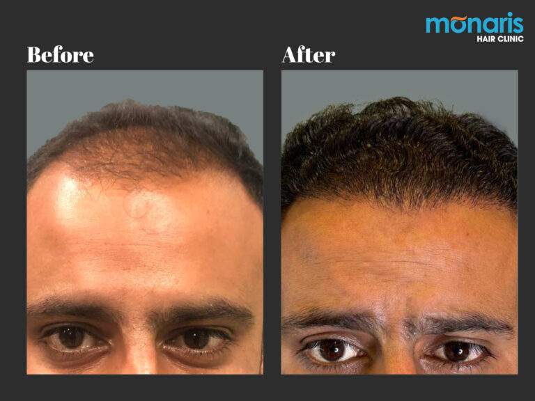 Patient comparison 36