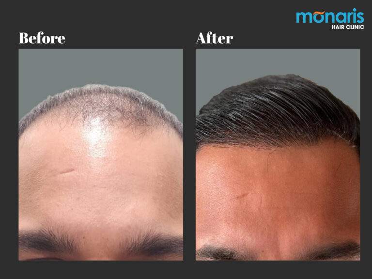 Patient comparison 35