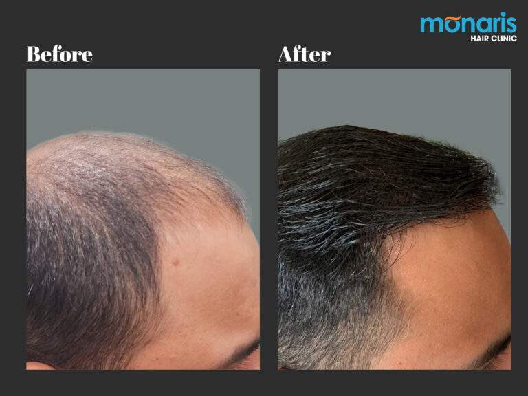Patient comparison 33