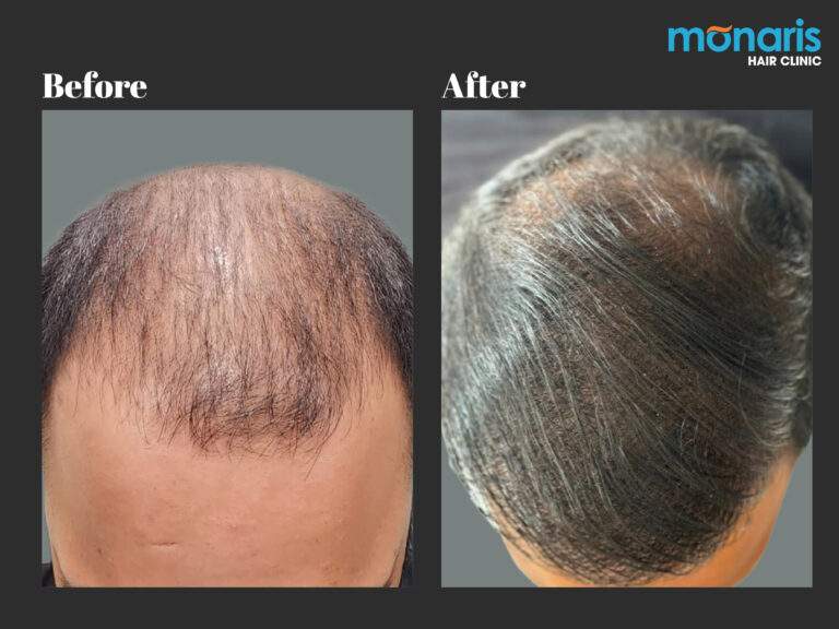 Patient comparison 34