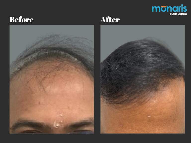 Patient comparison 37