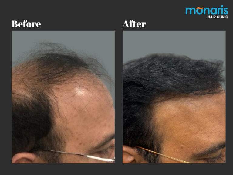 Patient comparison 38