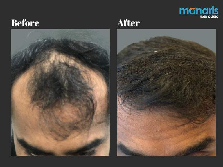 Patient comparison 40