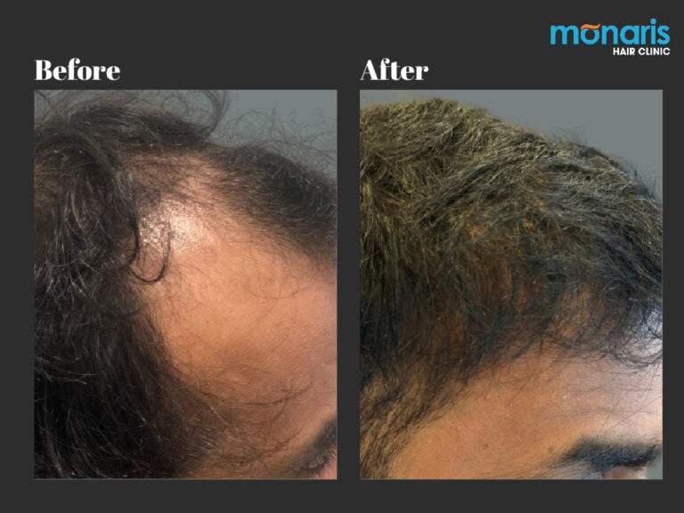Patient comparison 39