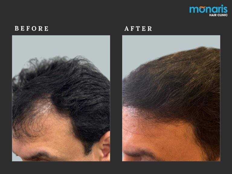 Patient comparison 48