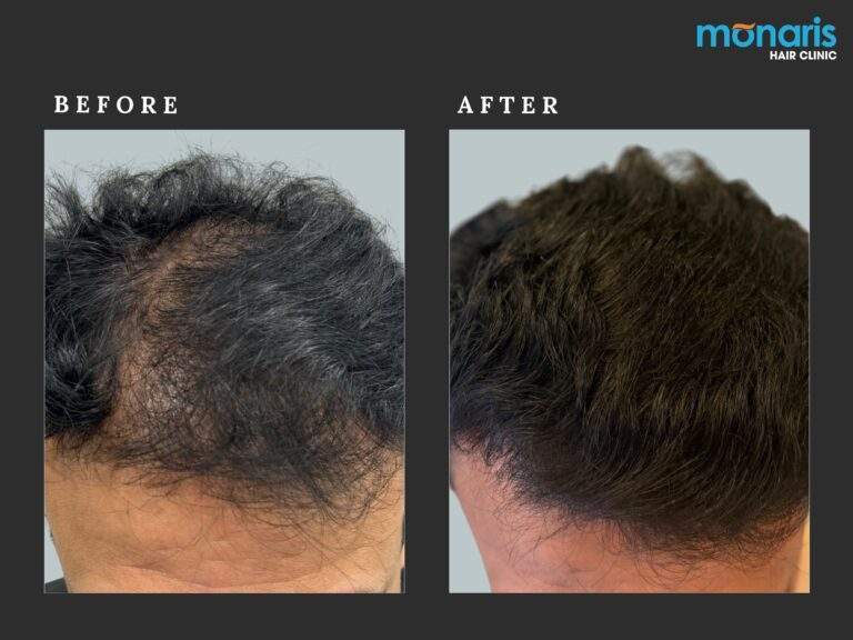 Patient comparison 47