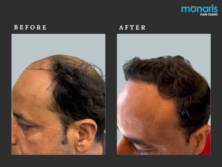 Patient comparison 45