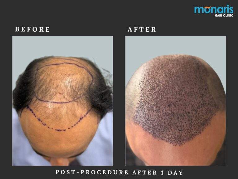 Patient comparison 43