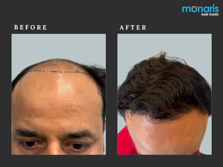 Patient comparison 42