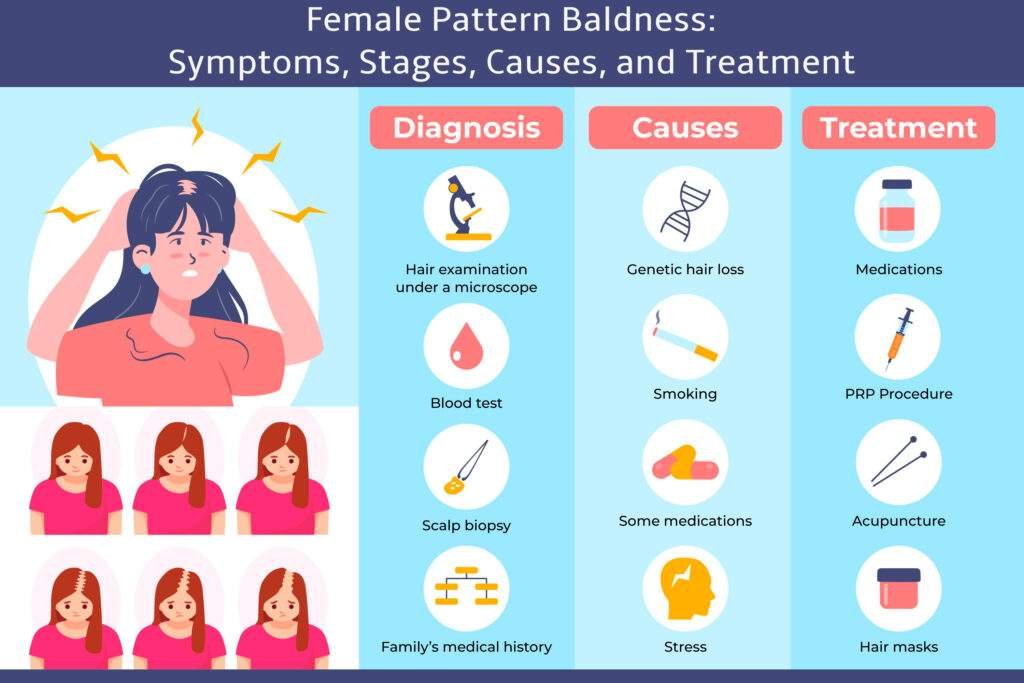 Female Pattern Baldness Symptoms Stages Causes and Treatment