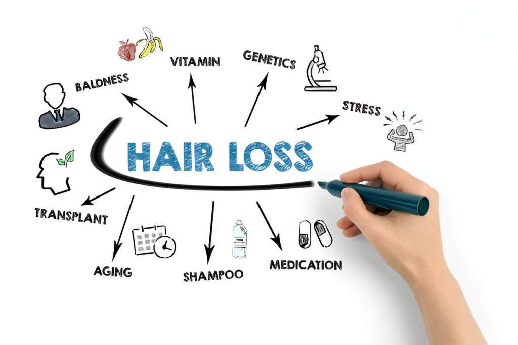 Genetics Hair Loss 1