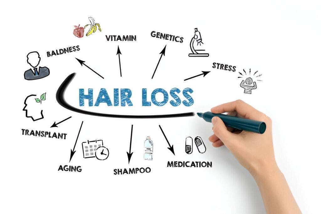 Genetics-Hair-Loss