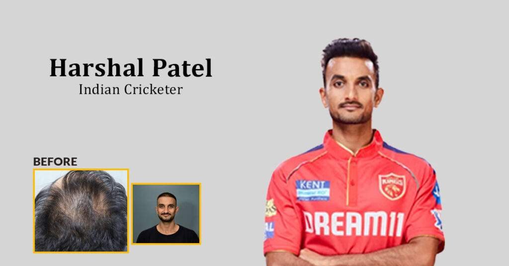HARSHAL web